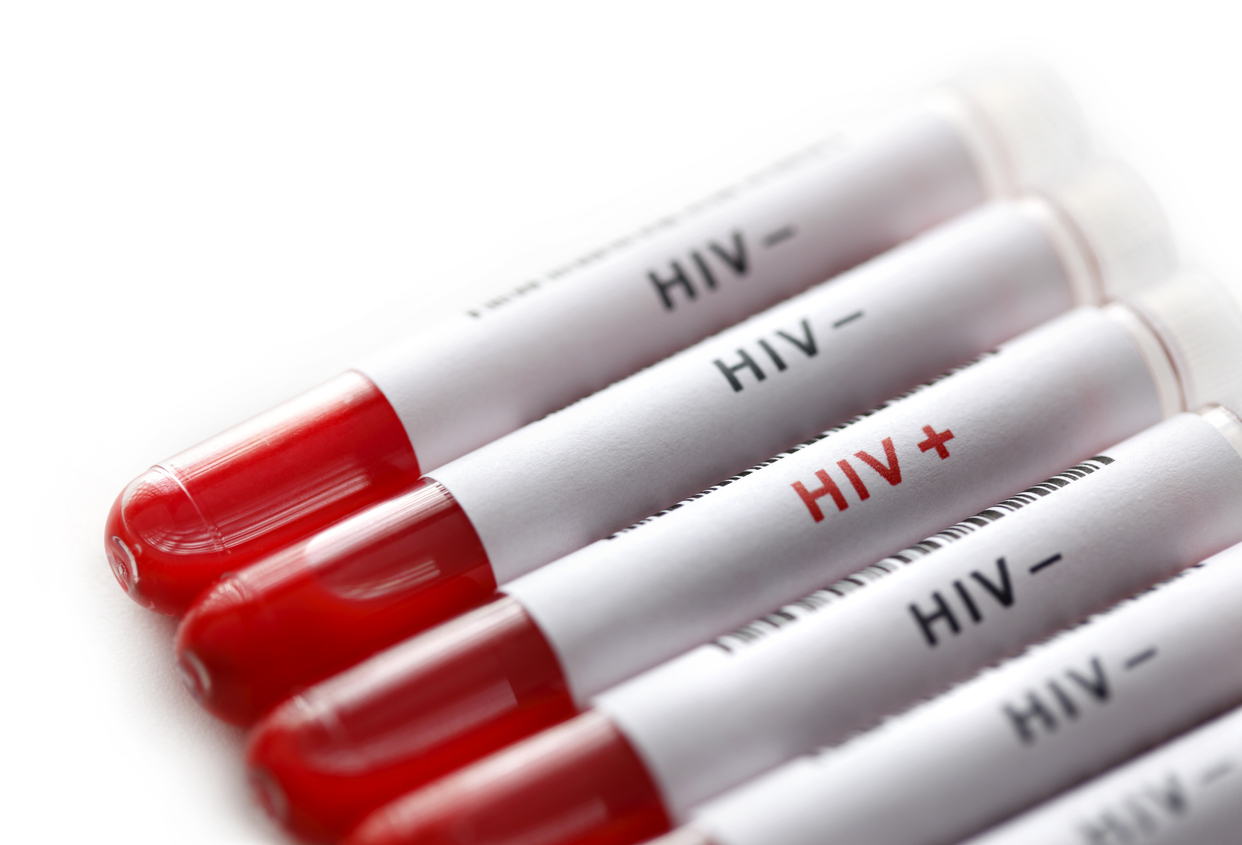 HIV tests and follow up are provided by Hazelhill Family Practice