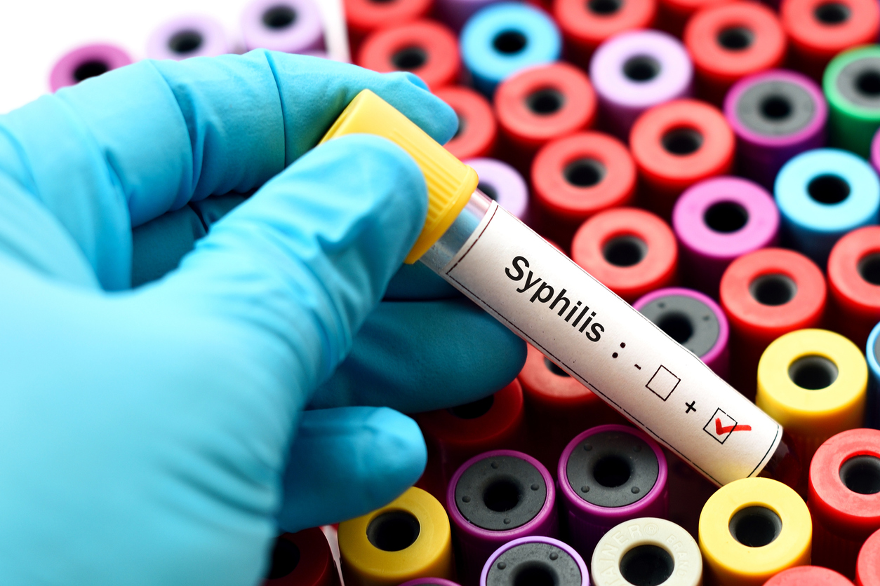 Testing for STDs such as syphilis is carried out for patients from across Mayo, Galway, Sligo and Roscommon at Hazelhill Family Practice.